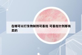 在哪可以打生物制剂可善挺 可善挺针剂那有卖的