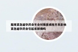 服用紧急避孕药会不会对银屑病有不良影响 紧急避孕药会引起皮肤病吗