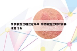 生物制剂注射注意事项 生物制剂注射时需要注意什么