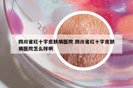 四川省红十字皮肤病医院 四川省红十字皮肤病医院怎么样啊