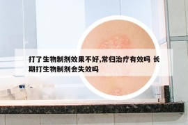 打了生物制剂效果不好,常归治疗有效吗 长期打生物制剂会失效吗