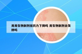 用用生物制剂抵抗力下降吗 用生物制剂会发胖吗