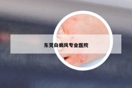 东莞白癜风专业医院