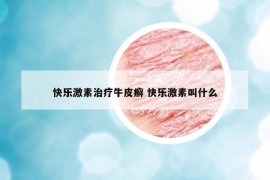 快乐激素治疗牛皮癣 快乐激素叫什么