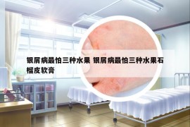 银屑病最怕三种水果 银屑病最怕三种水果石榴皮软膏