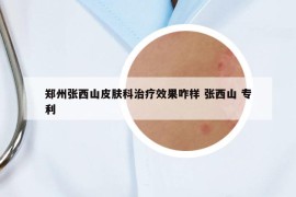 郑州张西山皮肤科治疗效果咋样 张西山 专利