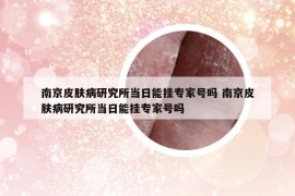 南京皮肤病研究所当日能挂专家号吗 南京皮肤病研究所当日能挂专家号吗