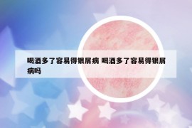 喝酒多了容易得银屑病 喝酒多了容易得银屑病吗