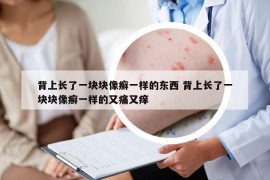 背上长了一块块像癣一样的东西 背上长了一块块像癣一样的又痛又痒