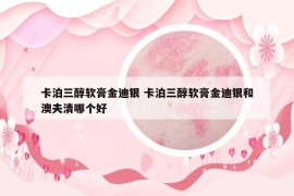 卡泊三醇软膏金迪银 卡泊三醇软膏金迪银和澳夫清哪个好