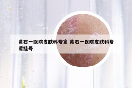 黄石一医院皮肤科专家 黄石一医院皮肤科专家挂号