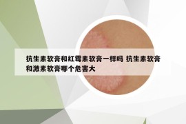 抗生素软膏和红霉素软膏一样吗 抗生素软膏和激素软膏哪个危害大