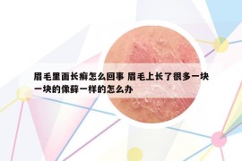 眉毛里面长癣怎么回事 眉毛上长了很多一块一块的像藓一样的怎么办