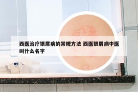 西医治疗银屑病的常规方法 西医银屑病中医叫什么名字