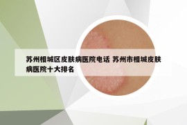 苏州相城区皮肤病医院电话 苏州市相城皮肤病医院十大排名