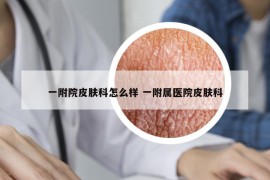 一附院皮肤科怎么样 一附属医院皮肤科