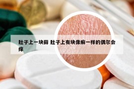 肚子上一块藓 肚子上有块像癣一样的偶尔会痒