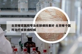 北京哪家医院专治皮肤病效果好 北京哪个医院治疗皮肤病权威
