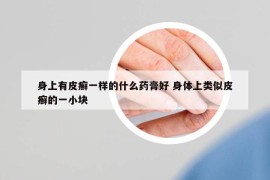 身上有皮癣一样的什么药膏好 身体上类似皮癣的一小块