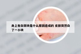 身上有白斑块是什么原因造成的 皮肤突然白了一小块