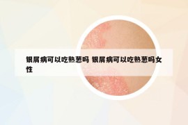 银屑病可以吃熟葱吗 银屑病可以吃熟葱吗女性