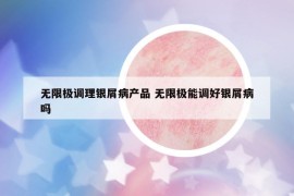 无限极调理银屑病产品 无限极能调好银屑病吗