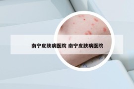 南宁皮肤病医院 南宁皮肤病医院