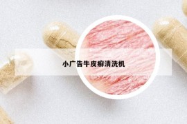 小广告牛皮癣清洗机