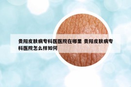 贵阳皮肤病专科医医院在哪里 贵阳皮肤病专科医院怎么样如何