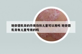 地奈德乳膏的作用功效儿童可以用吗 地奈德乳膏有儿童专用的吗