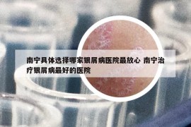 南宁具体选择哪家银屑病医院最放心 南宁治疗银屑病最好的医院