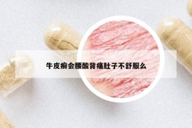 牛皮癣会腰酸背痛肚子不舒服么