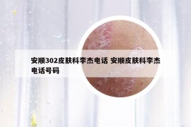 安顺302皮肤科李杰电话 安顺皮肤科李杰电话号码