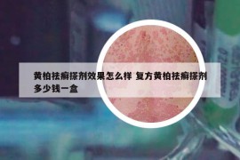 黄柏祛癣搽剂效果怎么样 复方黄柏祛癣搽剂多少钱一盒