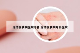 淄博皮肤病医院排名 淄博皮肤病专科医院