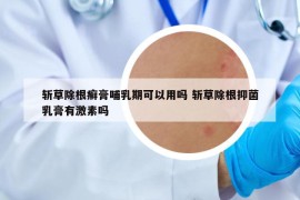 斩草除根癣膏哺乳期可以用吗 斩草除根抑菌乳膏有激素吗