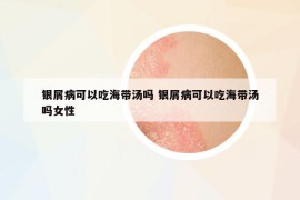 银屑病可以吃海带汤吗 银屑病可以吃海带汤吗女性