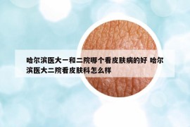 哈尔滨医大一和二院哪个看皮肤病的好 哈尔滨医大二院看皮肤科怎么样