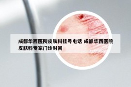 成都华西医院皮肤科挂号电话 成都华西医院皮肤科专家门诊时间