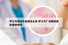 庐江马场治牛皮癣怎么样 庐江马厂皮肤科真的很神奇吗