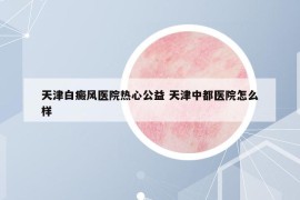 天津白癜风医院热心公益 天津中都医院怎么样