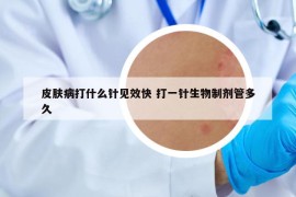 皮肤病打什么针见效快 打一针生物制剂管多久