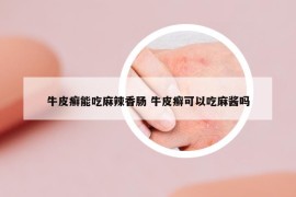 牛皮癣能吃麻辣香肠 牛皮癣可以吃麻酱吗