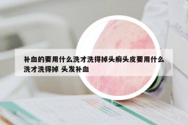 补血的要用什么洗才洗得掉头癣头皮要用什么洗才洗得掉 头发补血