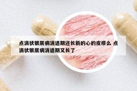 点滴状银屑病消退期还长新的心的皮疹么 点滴状银屑病消退期又长了