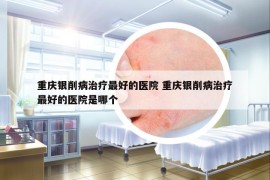 重庆银削病治疗最好的医院 重庆银削病治疗最好的医院是哪个