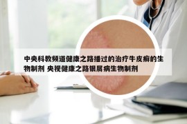 中央科教频道健康之路播过的治疗牛皮癣的生物制剂 央视健康之路银屑病生物制剂