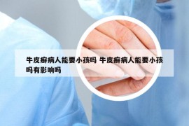 牛皮癣病人能要小孩吗 牛皮癣病人能要小孩吗有影响吗