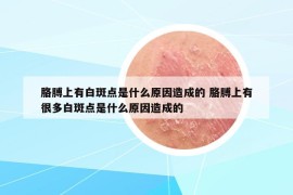 胳膊上有白斑点是什么原因造成的 胳膊上有很多白斑点是什么原因造成的