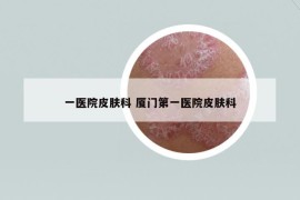 一医院皮肤科 厦门第一医院皮肤科